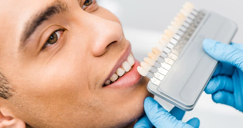 A doctor holding up a row of teeth next to an open faced man to match tooth color
